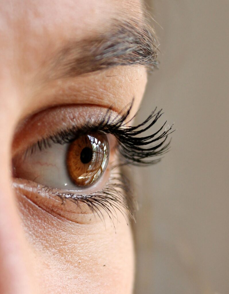 Blefaroplastia